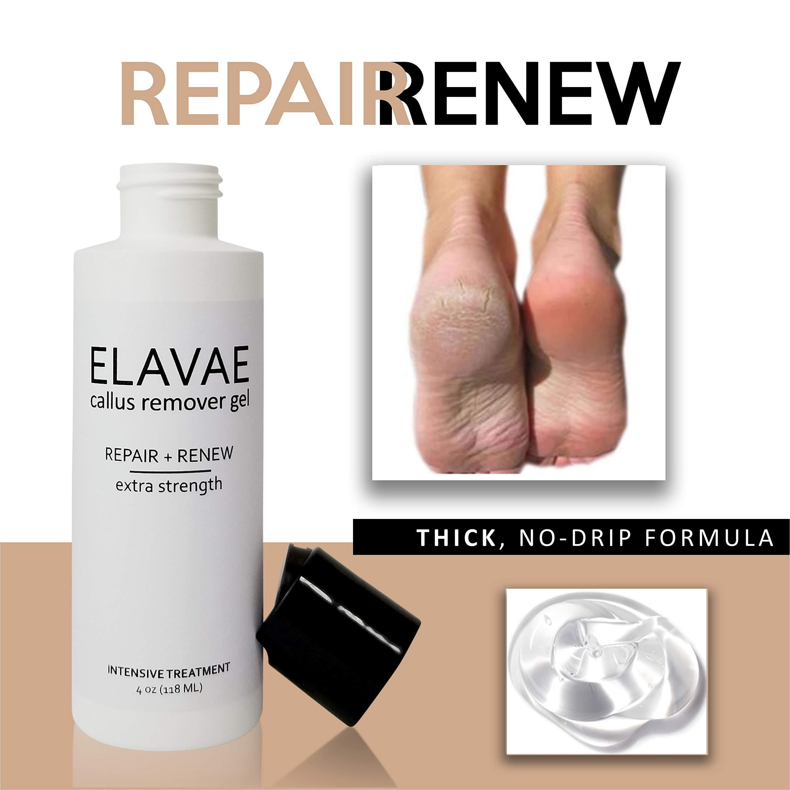 Extra Strength Callus Remover Gel & Foot Pumice Stone Set - For