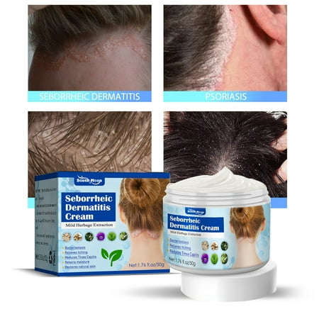 Yuxuan 50g/Box Itchy Skin Cream Non-irritating Easy to Absorb Healthy Safe Effective Anti-inflammatory Convenient Head Seborrheic Dermatitis Cream for Scalp