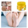CENGZISHU Pregnancy Feet Cracked Skin Banana Repair Cream Antifungal