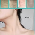 thumbnail image 5 of Instant Lift Neck Tape, Instant Neck Lift Tape, Neck Instant Lifting & Firming Invisible Tape, Anti-Wrinkle Patches for Necks Face Jaw, 5 of 5