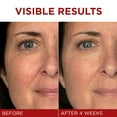thumbnail image 4 of L'Oreal Paris Revitalift Triple Power Face Moisturizer, Unscented Cream, 1.7 oz, 4 of 9