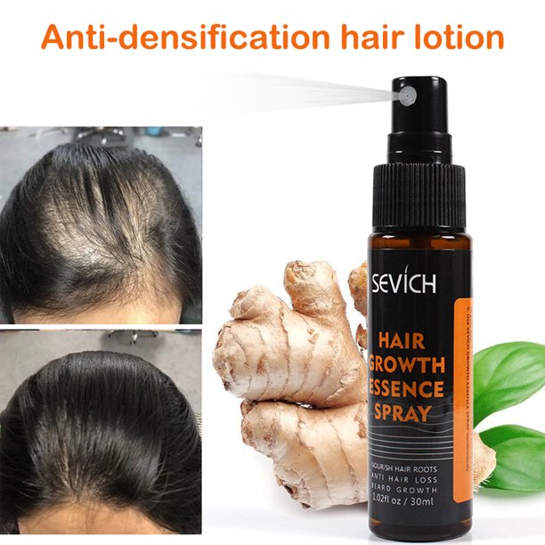 Hair Grow Spray Anti Hair Loss Thinning Balding Natural Ingredient Hair