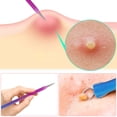 thumbnail image 4 of 7PCS Acne Tool Kit Steel Blackhead Tweezers Kit Comedone Extractor Kit with Case, 4 of 10