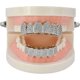 thumbnail image 2 of Diamond Grills for Your Teeth Women 18K Gold Plated Fully Iced Out CZ Vampire Top and Bottom Face Mouth Men with Extra Molding Bars Cosplay Costume--Silver set, 2 of 3