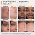 thumbnail image 3 of Sérum Ella & Eden Vitamina C para rostro con ácido hialurónico 30 ml, 3 of 6