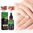 thumbnail image 3 of Suero reparador de uñas Zulema 50ml, 3 of 8