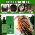 thumbnail image 2 of Spray para el crecimiento del cabello, 3 botellas, loción para el crecimiento del cabello, aceite para el cuidado del cabello, anticaída del cabello, 120 ml, 1 botella, 2 of 3