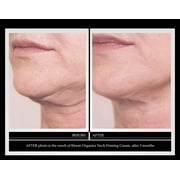 Kleem Organics Neck Firming Cream with Peptides & Retinol - Anti Aging Neck & Décolleté Moisturizer for Sagging Skin, Fine Lines & Wrinkles -1.7 fl oz