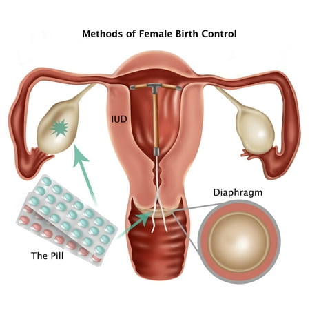Methods of Female Birth Control Poster Print by Gwen ShockeyScience