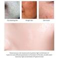 thumbnail image 4 of Crema retráctil de poros con ácido salicílico, eliminación rápida de poros grandes, eliminación de puntos negros, estiramiento de la cara, piel suave, producto coreano para el cuidado, 4 of 5