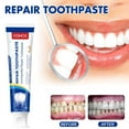 thumbnail image 4 of Repair Toothpaste, Loose Tooth Care Toothpaste, Gingival Care And Tooth Strengthening Toothpaste, Protect Teeth, 4 of 7