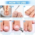 thumbnail image 4 of Kit de eliminación de uñas encarnadas con tiras para uñas encarnadas, parche corrector para uñas curvas, lima para uñas y herramientas para pedicura para mujer y hombre, 4 of 6