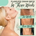 thumbnail image 2 of AMERTEER Fivfivgo Neck Tightening Roller, 2 of 4