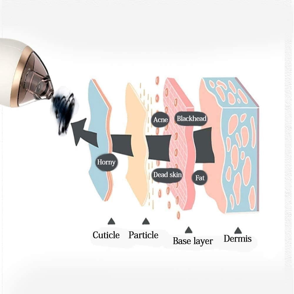 CNV Blackhead Remover Vacuum Pore Cleaner - Electric Blackhead Suction Devices USB Rechargeable, with 4 Adjustable Suction Intensities and 4 Replacement Probes