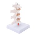 thumbnail image 4 of Anatomical Spine Model, Eco-friendly Anatomical Osteoporosis Model Safe Durable  For Model Display For Teaching For Doctor-patient Explanation, 4 of 8