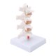 thumbnail image 5 of Modelo de osteoporosis, Modelo de osteoporosis profesional Modelo de anatomía humana Modelo de osteoporosis humana Diseño de próxima generación, 5 of 12