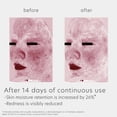thumbnail image 5 of Limpiador Facial EltaMD Skin Recovery con Aminoácidos 150 ml, 5 of 5
