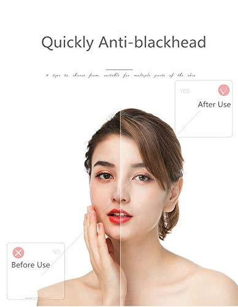 Microcrystaline Blackhead Remover