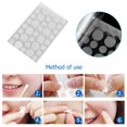thumbnail image 4 of 36 unids/bolsa acné Pimple Master parches cara punto cicatriz cuidado tratamiento pegatinas Likrtyny cuidado belleza, 4 of 6