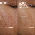 thumbnail image 3 of Sérum Dr. Brandt Bright This Way Dark Spots, 15 ml (paquete de 2), 3 of 8