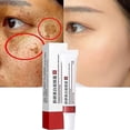 thumbnail image 1 of Crema blanqueadora eficaz para pecas, elimina el Melasma, pigmento para manchas de acné, pigmentación de manchas oscuras, Gel hidratante para el cuidado de la piel, 1 of 3