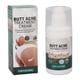 thumbnail image 1 of Crema para el acné en los glúteos para un alivio claro e hidratado, 100 ml Smooth Skin Rescue, 1 of 8