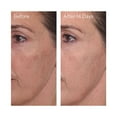 thumbnail image 2 of Rapid Dark Spot Correcting Serum Travel Size, 2 of 4