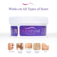thumbnail image 6 of Derminish Scar Wipes - Acne & Scar Remover, Stretch Mark Pads - 50 Pads, 6 of 11