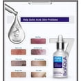 thumbnail image 4 of Crema de eliminación de cicatrices de acné facial BIOAQUA 4 en 1 100 g+30 g+30 ml, 4 of 9