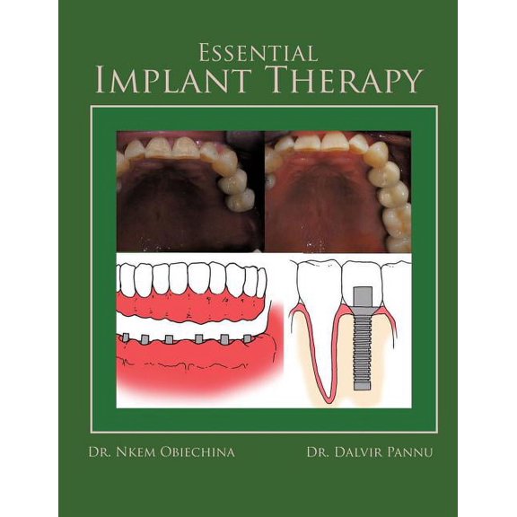 Essential Implant Therapy: A Patient's Guide to Understanding Implant Dentistry, (Paperback)
