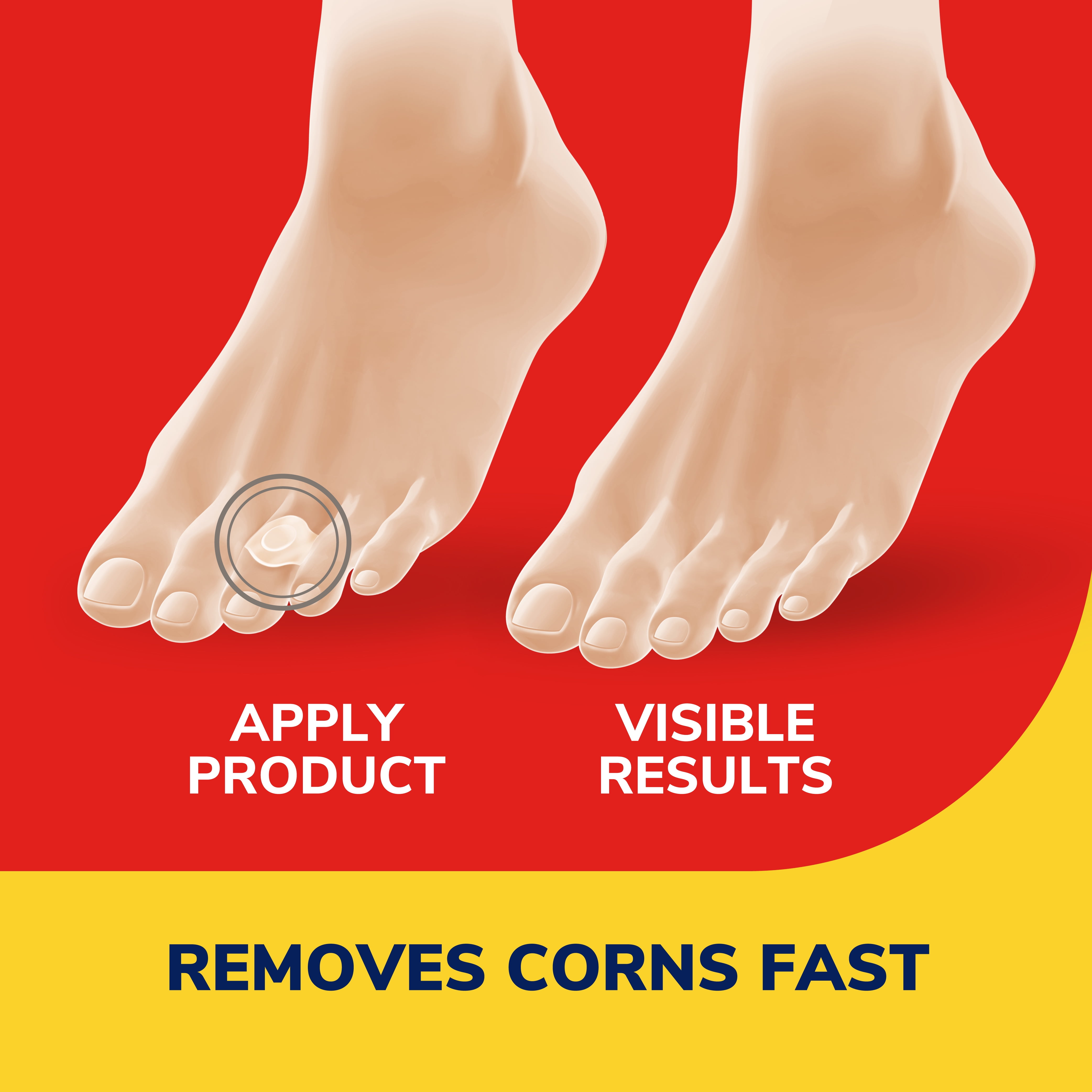 Dr. Scholl's Corn Remover Pads Remover Cushions, 9 Count