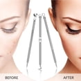 thumbnail image 3 of Injueey 7 Pieces Blackhead Removal Tool Kit Tools Cleaning Care Face Remover Pimple Oil Tool Extractor Dirt Almacenamiento y organización del hogar, 3 of 6