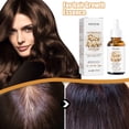 thumbnail image 1 of XYAIYT Revitalize Your Hair with Rice Water Oil Frizz Control Deep Conditioning,Non Greasy Hair Repair Lotion for Glossyer,Better Health Locks 30ml, 1 of 9