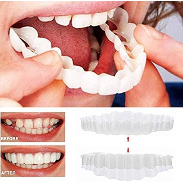 Carillas instantáneas JM Dentaduras postizas ajuste cómodo superior e inferior