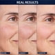 thumbnail image 3 of Sérum de noche No7 Future Renew Damage Reversal - Sérum facial antiedad con péptidos - Formulado con ácido hialurónico y niacinamida para ayudar a revertir los signos visibles del daño en la piel dura, 3 of 8