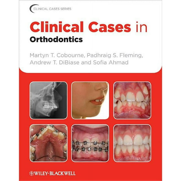 Clinical Cases (Dentistry) Clinical Cases in Orthodontics, Book 6, (Paperback)