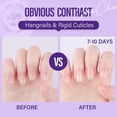 thumbnail image 4 of Aceite para cutículas CHUCHU Lavanda y jojoba con vitaminas B y E, 15 ml, 4 of 5
