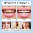 thumbnail image 4 of 1-3x 60ml Tooth care solution Dentite Cavity Healing Tooth Armor, 4 of 5