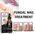 thumbnail image 3 of Nail Fungus-Treatments for Toenails Quick Absorption Nail Strengthening Liquid for Damaged-Nails, 3 of 5