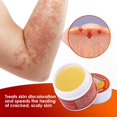 thumbnail image 4 of Ungüento antipruriginoso para la piel, crema antibacteriana para pie de atleta, para Beriberi, picazón, tiña, dermatitis, eccema, 4 of 5