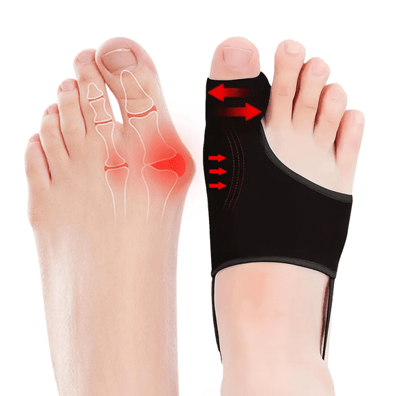Bunion Corrector for Women/Man Big Toe Straightener Bunion Corrector, Relief splints Reduce Pain and Correct Toe Alignment, Brace Day/Night, fit for R/L,Washable(Black 2-Pack)