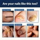 thumbnail image 5 of Fungal Nail Treatment Cream, Strong Anti-Fungal Toenail Cream, Fungal Nail Treatment For Toenail Fungus & Nail Repair, 5 of 5