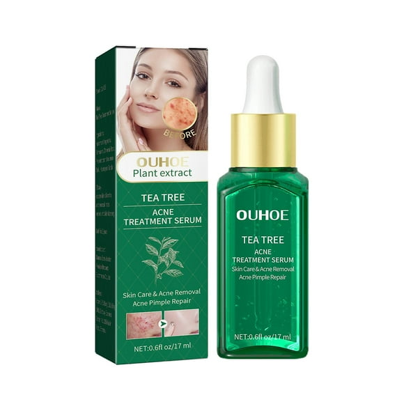 Acne Treatment Essence 17Ml