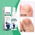 thumbnail image 6 of RAGUPEL Natural Foot&Shoe Deodorizer Spray-Foot Spray for Smelly Feet&Shoe Spray for Smelly Shoes-Removes,Controls&Prevents Odors-Shoe Deodorizer Spray Made with Essential Oils, 6 of 9