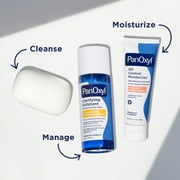 PanOxyl Acne Treatment Bar, Max Strength 10% Benzoyl Peroxide, 4 oz