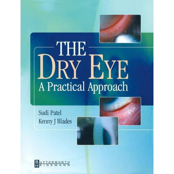 The Dry Eye: A Practical Approach, (Paperback)