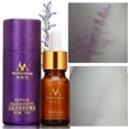 thumbnail image 4 of Aceites esenciales Aceite de lavanda para el cuidado de la piel, aceite líquido para el acné, cicatriz 10ml (Buy 2 get 1 free), 4 of 9