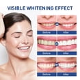 thumbnail image 6 of Rewenti Instant Whiten Colour for Teeth Instant Whiten Colour for Teeth Teeth Whiten Paint Bottles Teeth Whiten Paint White Teeth Instant Whiten 5ml, 6 of 9