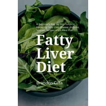 Fatty Liver Diet: A Beginner's Step by Step Guide to Managing Fatty Liver Disease: Includes Selected Recipes and a , (Paperback)