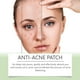 thumbnail image 5 of Acne Removal Acne Patch Acne Removal Acne Skin Care Facial Care Cover Acne Seal Waterproof Patch, 5 of 5